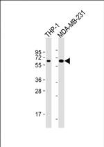 MB21D1 Antibody in Western Blot (WB)