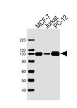 TOP1 Antibody in Western Blot (WB)