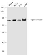 TOP1 Antibody in Western Blot (WB)