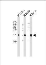 LC3 Antibody in Western Blot (WB)