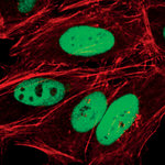 c-Jun Antibody in Immunocytochemistry (ICC/IF)