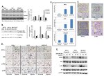 Phospho-c-Met (Tyr1003) Antibody in Western Blot, Immunohistochemistry (Paraffin) (WB, IHC (P))