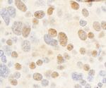 c-Myb Antibody in Immunohistochemistry (IHC)