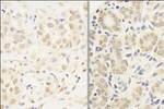 c-Myb Antibody in Immunohistochemistry (IHC)