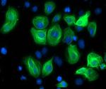 c-Myc Antibody in Immunocytochemistry (ICC/IF)