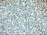 c-Myc Antibody in Immunohistochemistry (Paraffin) (IHC (P))