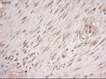 c-Myc Antibody in Immunohistochemistry (Paraffin) (IHC (P))