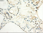 c-Myc Antibody in Immunohistochemistry (Paraffin) (IHC (P))