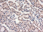 c-Myc Antibody in Immunohistochemistry (Paraffin) (IHC (P))