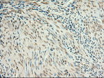 c-Myc Antibody in Immunohistochemistry (Paraffin) (IHC (P))