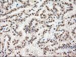 c-Myc Antibody in Immunohistochemistry (Paraffin) (IHC (P))