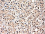 c-Myc Antibody in Immunohistochemistry (Paraffin) (IHC (P))