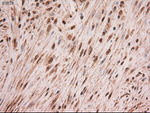 c-Myc Antibody in Immunohistochemistry (Paraffin) (IHC (P))