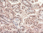 c-Myc Antibody in Immunohistochemistry (Paraffin) (IHC (P))