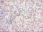 c-Myc Antibody in Immunohistochemistry (Paraffin) (IHC (P))