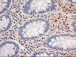 c-Myc Antibody in Immunohistochemistry (Paraffin) (IHC (P))