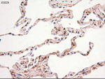 c-Myc Antibody in Immunohistochemistry (Paraffin) (IHC (P))