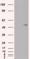 c-Myc Antibody in Western Blot (WB)