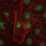 c-Rel Antibody in Immunocytochemistry (ICC/IF)