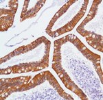 ErbB3 Antibody in Immunohistochemistry (Paraffin) (IHC (P))