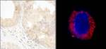 cAbl Antibody in Immunohistochemistry (IHC)