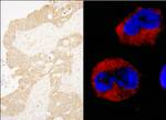 cAbl Antibody in Immunohistochemistry (IHC)