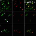 SSB Antibody in Immunocytochemistry (ICC/IF)