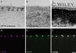 CD73 Antibody in Immunohistochemistry (IHC)