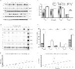 Phospho-Tau (Thr212) Antibody in Western Blot (WB)