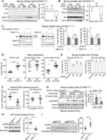 p38 MAPK beta Antibody in Western Blot (WB)