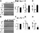 Phospho-INSR (Tyr972) Antibody in Western Blot (WB)