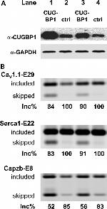 CaV1.1 Antibody in Western Blot (WB)