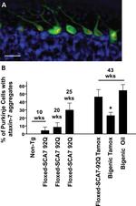 Ataxin 7 Antibody in Immunohistochemistry (IHC)