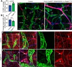 CD140b (PDGFRB) Antibody in Immunohistochemistry (IHC)