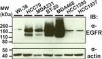 EGFR Antibody in Western Blot (WB)