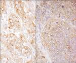 eEF2 Antibody in Immunohistochemistry (IHC)