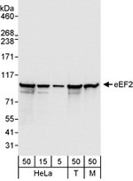 eEF2 Antibody in Western Blot (WB)