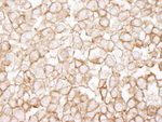 eEF2 Antibody in Immunohistochemistry (IHC)