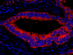 eEF2 Antibody in Immunohistochemistry (IHC)