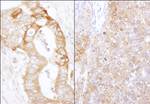 eEF2 Kinase Antibody in Immunohistochemistry (IHC)