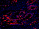 eEF2 Kinase Antibody in Immunohistochemistry (IHC)