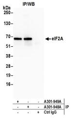 eIF2A Antibody in Immunoprecipitation (IP)