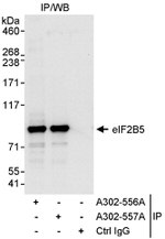 eIF2B5 Antibody in Immunoprecipitation (IP)