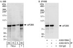 eIF2B5 Antibody in Western Blot (WB)