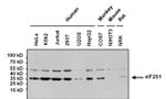 EIF2S1 Antibody in Western Blot (WB)