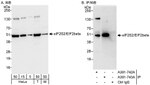 eIF2beta/EIF2S2 Antibody in Western Blot (WB)