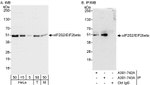 eIF2beta/EIF2S2 Antibody in Western Blot (WB)