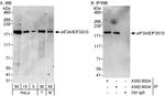 eIF3A/eIF3S10 Antibody in Western Blot (WB)