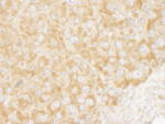 eIF3A/eIF3S10 Antibody in Immunohistochemistry (IHC)