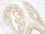 eIF3A/eIF3S10 Antibody in Immunohistochemistry (IHC)